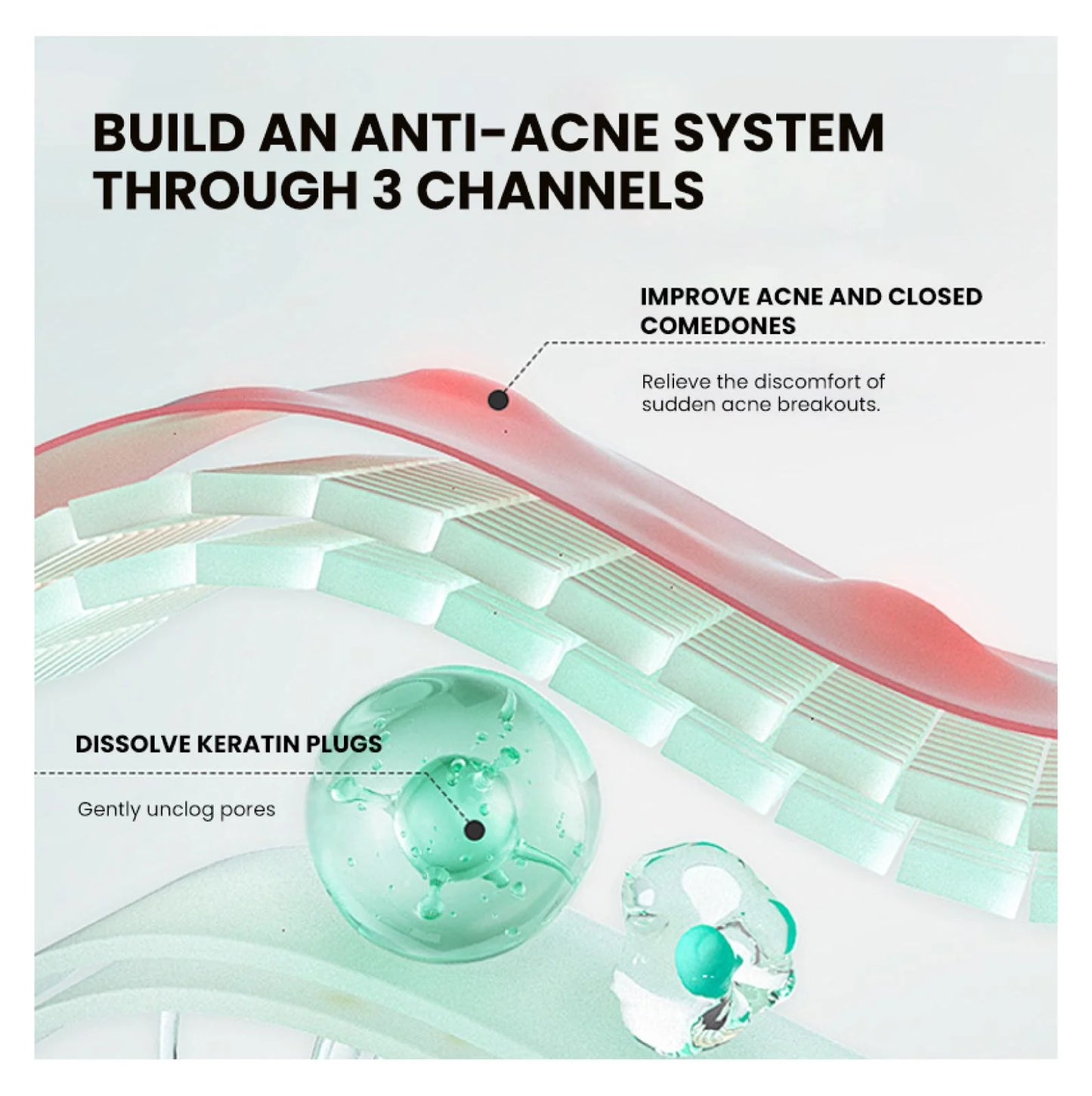 BUILD AN ANTI-ACNE SYSTEM THROUGH 3 CHANNELS